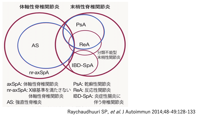 強直性脊椎炎を診断する医師は何ですか?