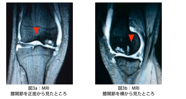 この状態の見通し