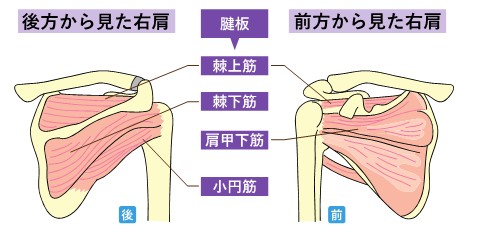 腱板断裂01