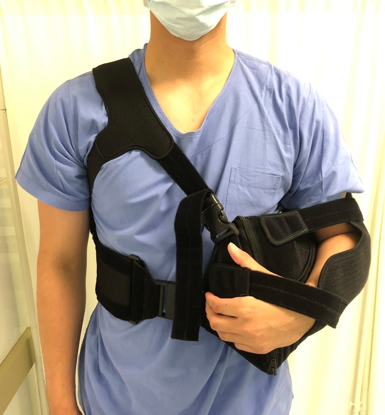 腱板断裂06