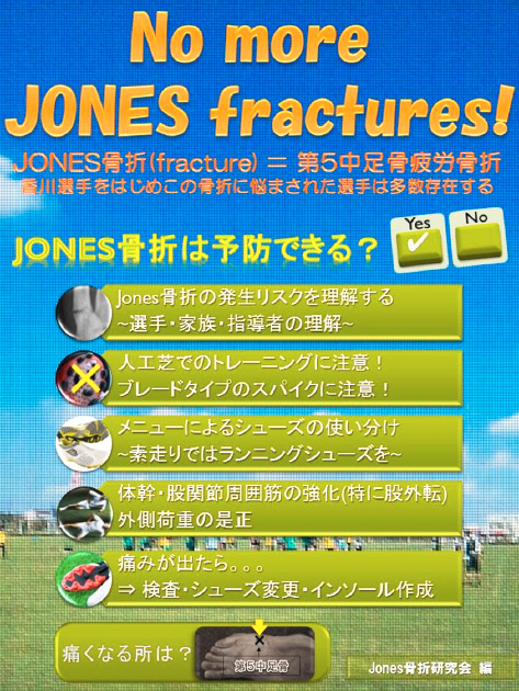 Jones骨折02