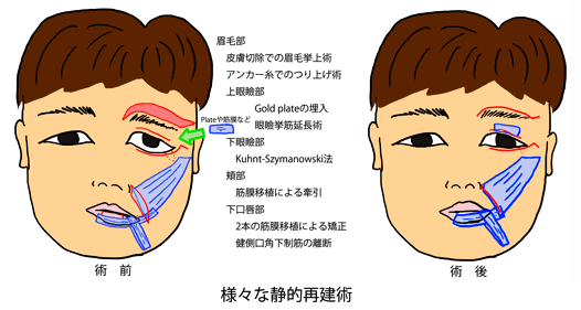 顎関節症が神経損傷を引き起こしているかどうかをどうやって知ることができますか?