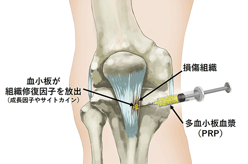 再生医療の取り組み03